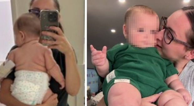 «Il mio bambino a sei mesi pesa già 10 chili. Indossa pannolini della taglia più grande»