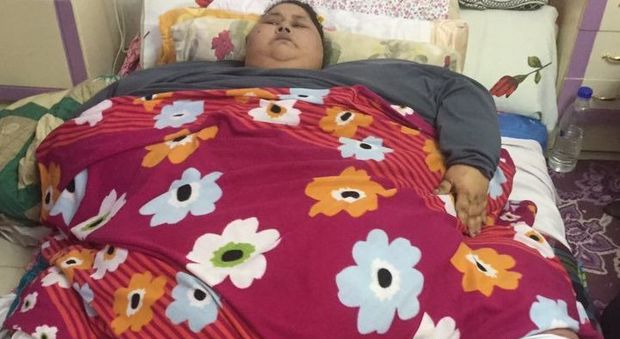 La donna più grassa del mondo pesa 500 chili: sarà presto operata in India - Foto