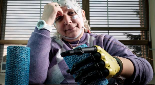 Mano bionica impiantata ad una donna italiana: l'intervento rivoluzionario al Gemelli di Roma