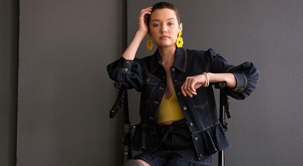Claire, la modella 21enne che ha perso entrambe le gambe: «Chiunque si sarebbe scoraggiato, ma non lei»