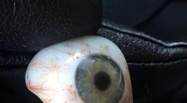 Trova la protesi di un occhio mentre passeggia per strada, appello di un giovane al proprietario