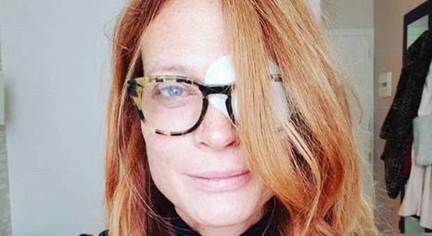Jane Alexander, grave problema di salute: «Ho una lesione alla cornea»
