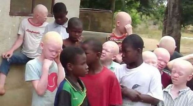 Africa, albini uccisi per rituali vudù e messe nere: ordine di sparare a vista contro criminali