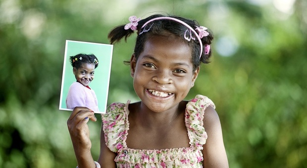 Fondazione Operation Smile Italia ETS, al via la campagna “un sorriso globale”: curare migliaia di bambini nel mondo con malformazioni del volto