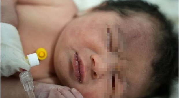 Migliaia di richieste di adozione per Aya, la neonata sopravvissuta alla sua famiglia dopo il terremoto
