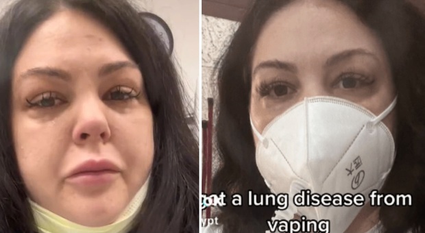 Vuole smettere di fumare e compra un vaporizzatore: «Rischio di morire dopo averlo usato 5 mesi. Ho annullato il mio matrimonio»