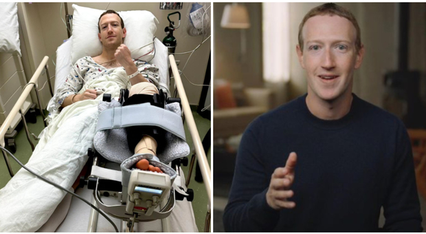 Mark Zuckerberg, la foto choc dall'ospedale: «Sono grato ai medici»