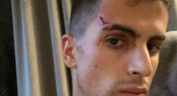 Joao Cancelo, notte di terrore a Manchester: «Mi hanno aggredito e rapinato in casa»