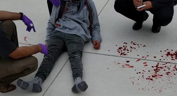 Studente disabile picchiato a sangue dai bulli, la mamma denuncia su Fb: "La scuola ha finto di non vedere"