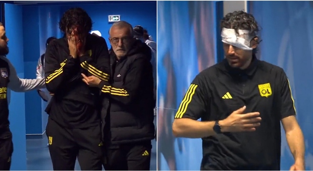  Fabio Grosso, tensione a Marsiglia: sassi sul pullman del Lione, il tecnico ferito al volto. Annullata la partita 