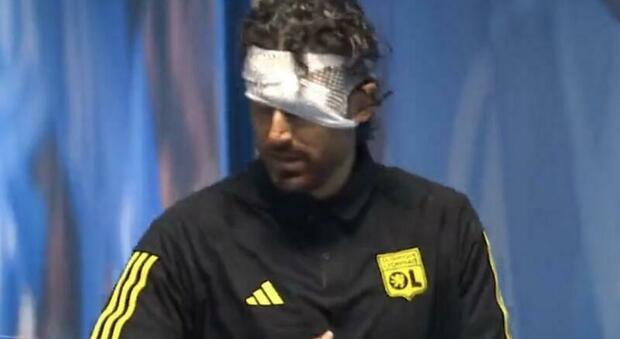 Fabio Grosso colpito al volto