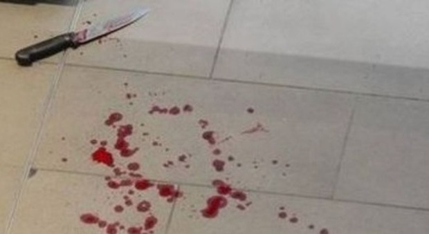 Diciassettenne ferisce 2 operatori col coltello in struttura accoglienza