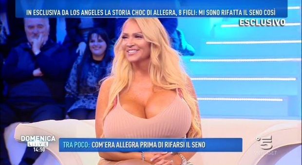 Domenica Live, chirurgia estetica estrema: il Ken italiano e la donna con la 15esima di seno