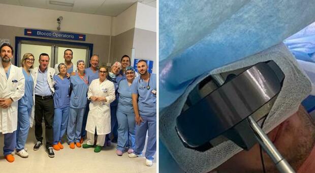 La realtà virtuale per operare un paziente (da sveglio) con un tumore cerebrale: l'intervento dell'equipe del dottor Trignani