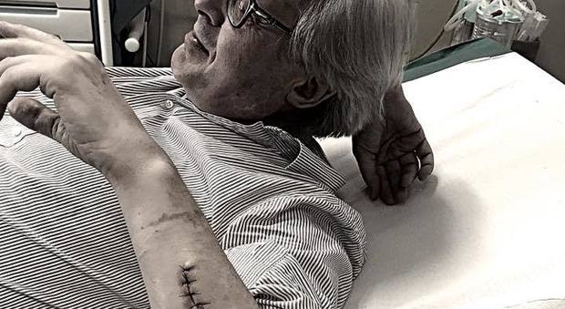 Vittorio Sgarbi, la foto sul lettino dell'ospedale fa preoccupare i fan: "Cucito a mano..."