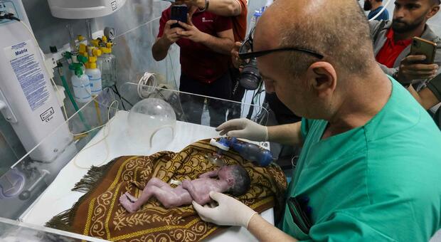 Gaza, miracolo sotto le bombe: Rouh salvata con un cesareo mentre la mamma moriva