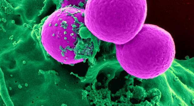Tumori, svolta per la cura: scoperta una pillola innovativa in grado di "uccidere tutti i tipi di cancro"