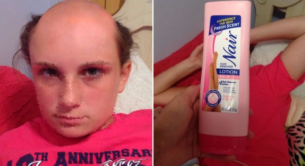 La ragazza confonde lo shampoo con la crema depilatoria: il disastro è virale, ma falso