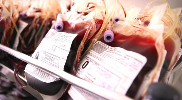 Trasfusione sangue infetto nel 1979, lo Stato dovrà risarcire 350mila euro a un pensionato napoletano