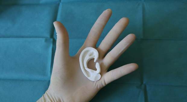 Nato senza un orecchio, glielo ricostruiscono con la stampa 3D: l'intervento su un ragazzo di 13 anni