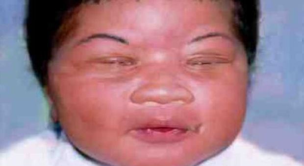 Neonata rapita dalla culla dell'ospedale, ritrovata 18 anni dopo grazie al dna