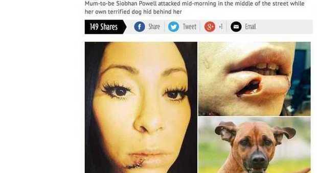 Un cane la aggredisce mentre passeggia col suo bulldog: 24enne incinta sfregiata sul volto