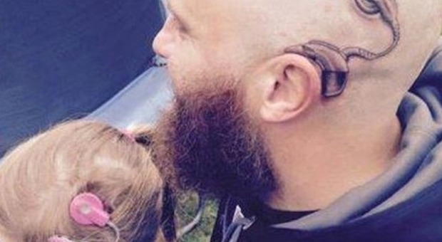 La figlioletta sorda deve indossare un apparecchio vistoso: il papà se lo fa tatuare sulla testa