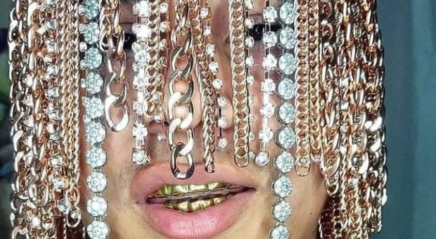 Catene d'oro al posto dei capelli: chi è il rapper messicano che si è fatto impiantare diamanti in testa