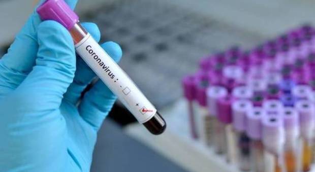 Coronavirus a Napoli: due morti in 24 ore e torna a salire il numero dei contagi