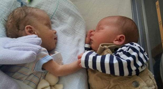 Fratello in fin di vita, i gemellini mano nella mano nell'incubatrice commuovono il web