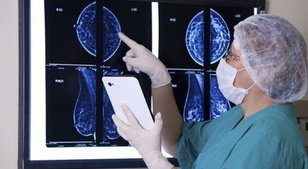Tumore seno, nuova terapia disponibile in Italia: «Meno invasiva e più rapida»