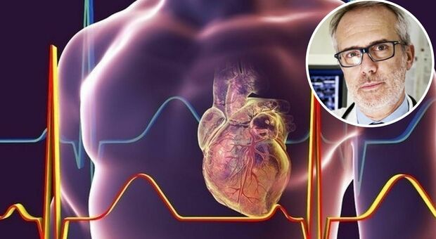 Gigi Riva e il piccolo infarto: sintomi, cause, terapia e come si estende. Il cardiologo: «Può essere fatale»