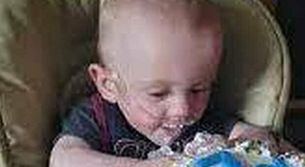 Il bimbo prematuro più piccolo degli USA sopravvive e festeggia il suo primo compleanno