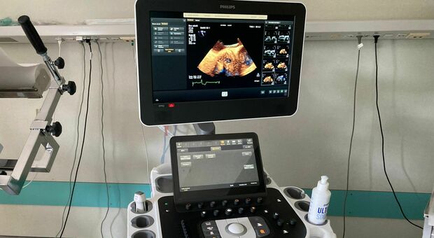 All'ospedale di Bassano arriva un ecocardiografo che usa intelligenza artificiale