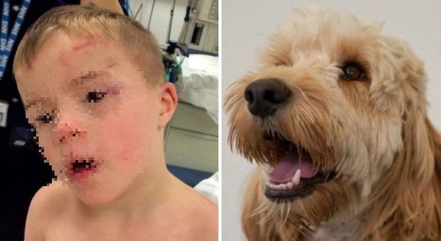 Bimbo down di 5 anni incastrato nell'asciugatrice accesa, salvato dal suo cane