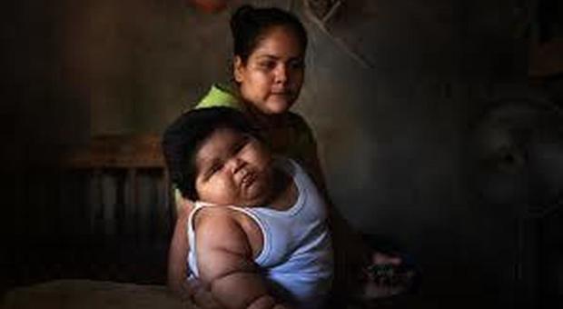 Messico, ha 10 mesi ma pesa come un bambino di 9 anni: il caso anomalo di un bimbo