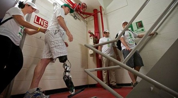Perde la gamba in un incidente, torna a camminare con arto bionico