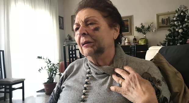 Picchiata dal fidanzato, un'anziana la difende: colpita a pugni in faccia
