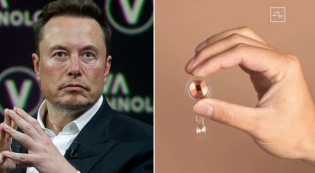 Neuralink,il primo chip di Elon Musk impiantato nel cervello umano che sta dividendo l'opinione dei medici