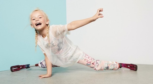 Daisy, baby-modella con le gambe amputate sfilerà alla Fashion Week di New York