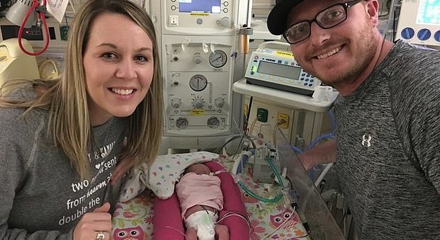 Nascono alla 22esima settimana, gemelline sopravvivono entrambe: «Avevano solo il 10% delle possibilità»