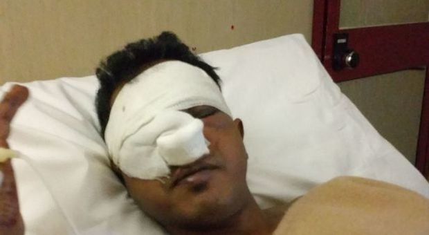 Nettuno, venditore di rose bengalese picchiato a sangue da due 20enni