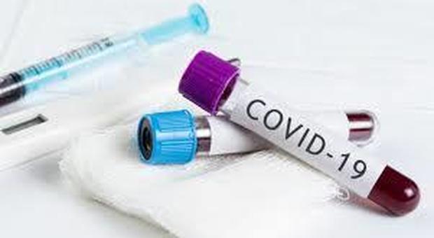 Coronavirus Vicenza. Tredici nuovi contagiati, dimezzati i pazienti in terapia intensiva
