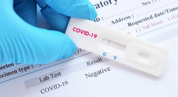 Coronavirus e rientri in Campania, pronti 10mila kit per i test rapidi