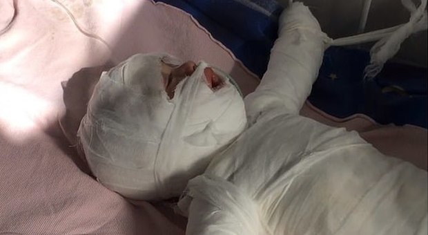 Morto Daniil, bimbo di 11 mesi caduto nella pentola dell'acqua bollente mentre faceva il bagnetto