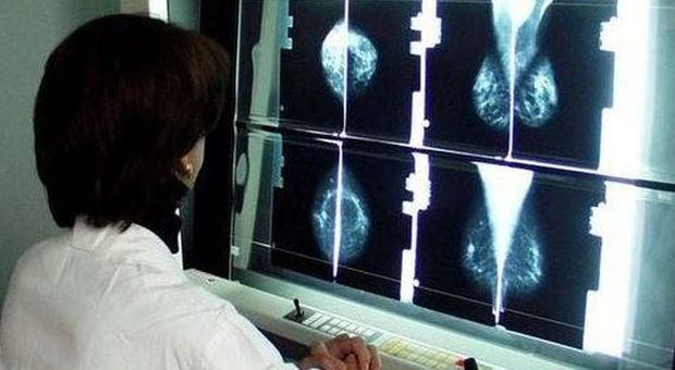 Un medico analizza una mammografia