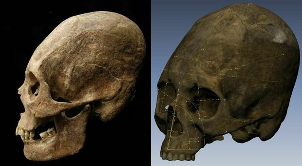 Cranio di donna allungato scoperto nelle catacombe di Chiusi: «Fu deformato volontariamente»