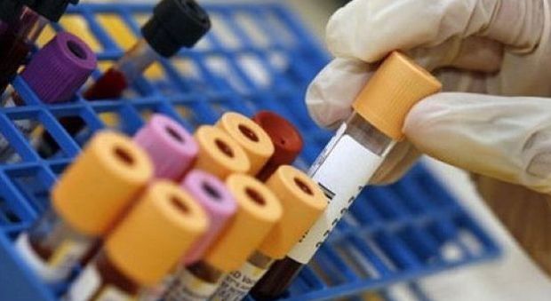 Nuovo test del sangue per la diagnosi precoce di otto tumori