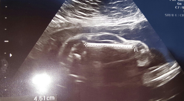 Donna incinta va a fare l'ecografia: le immagini sorprendono...
