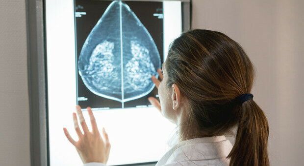 Tumore al seno, con i test genomici -36% di chemioterapie